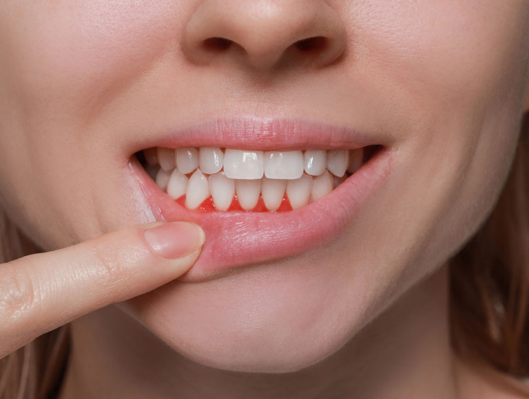 Are You Experiencing Gum Problems?