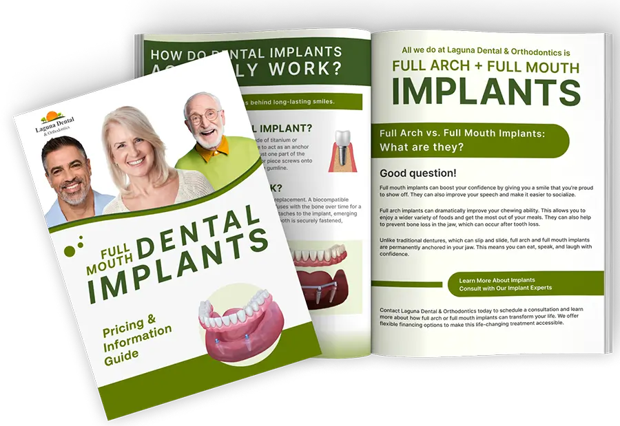 Dental Implant Guide